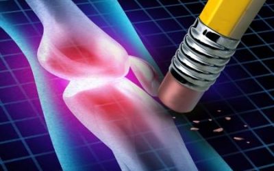 Rheumatoid arthritis: a gyógyszerektől a kezelési tervig vezető út