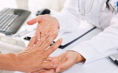 A rheumatoid arthritis
